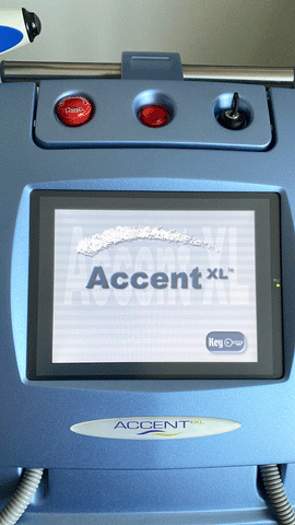 Picture of the screen for 2008 Alma Accent XL Laser Machine