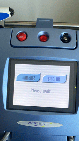 Picture of the screen for 2008 Alma Accent XL Laser Machine