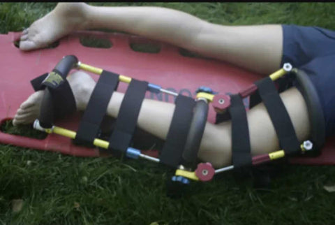 The Reel Splint / Adult Splint Traction and Extraction System – One ...