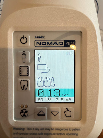 Digital display of a Aribex Nomad Pro Handheld Dental Intraoral System
