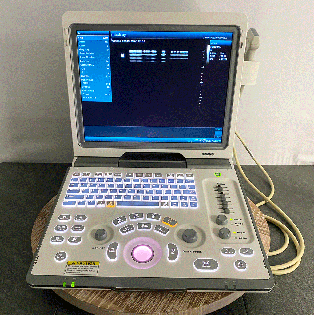 Front picture of the Mindray DP-50 Digital Ultrasound System with 75L38EA Linear Transducer 