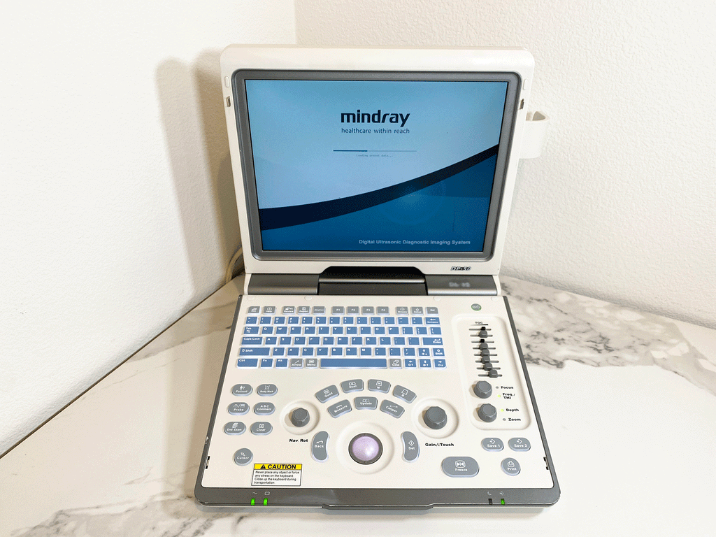 Front picture of the Mindray DP-50 Digital Ultrasound System