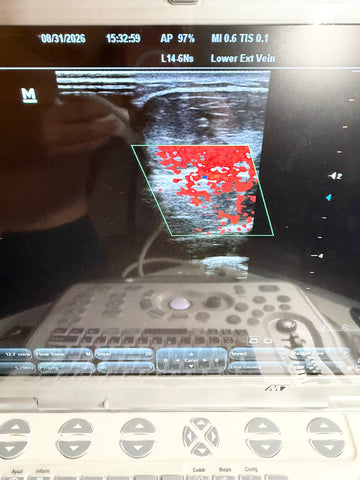 A Mindray portable ultrasound machine with a control panel and a screen showing an ultrasound image, photographed in a clinical setting.