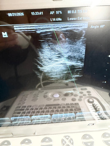 A medical ultrasound machine with a screen showing an ultrasound image and a keyboard below, photographed in a real environment with reflections on the monitor.