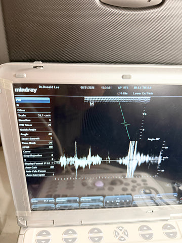 A Mintray portable ultrasound machine with a white plastic housing and a black screen displaying an ultrasound waveform, set against a gray textured background.