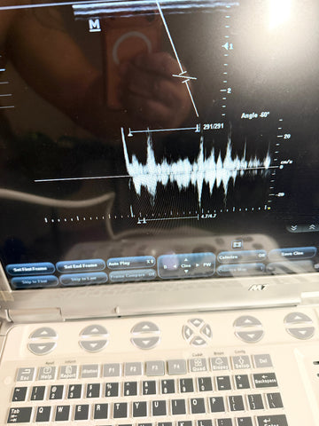 A close-up of a screen displaying an ultrasound waveform and angle measurement interface, with part of the keyboard visible below.