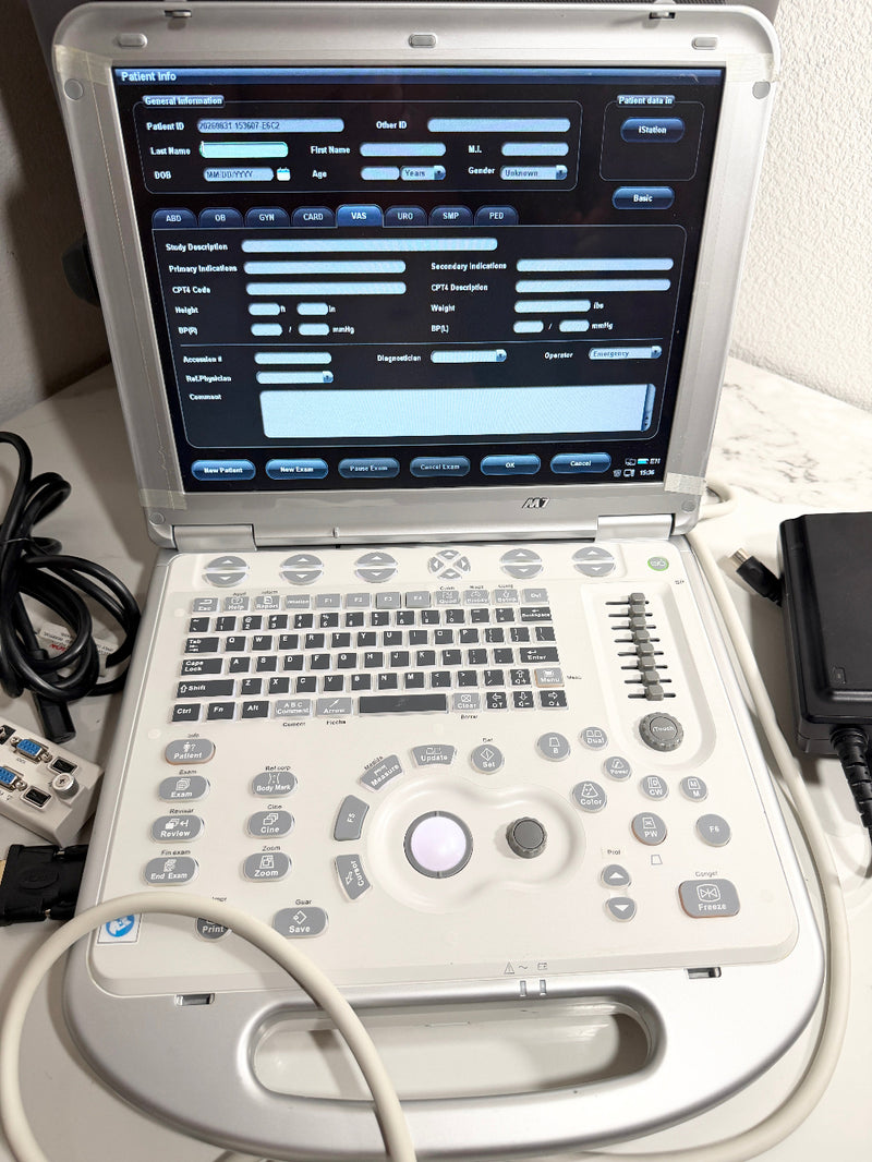 A portable ultrasound machine with a white and gray control panel, open screen showing diagnostic software, and attached cables on a light-colored surface.
