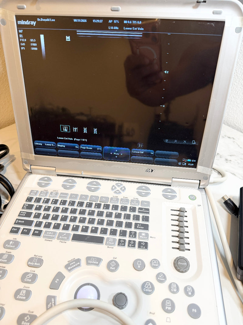 A Mintray portable ultrasound machine with a white plastic housing, gray buttons, and a black screen, shown open on a light-colored surface with cables nearby.