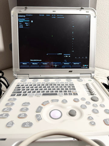 A Mindey ultrasound machine with an open white and gray control panel, showing the screen on and some cables at the side, photographed indoors against a light wall.