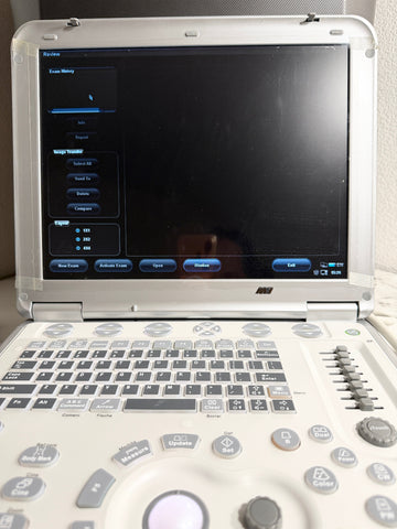An open Mindray portable ultrasound machine with a white console, gray keyboard keys, and a black screen showing the ultrasound interface.
