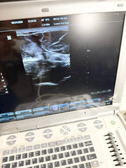 An ultrasound machine with a control panel and a screen displaying a grayscale medical scan.