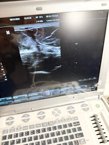 An ultrasound machine with a control panel and a screen displaying a grayscale medical scan.