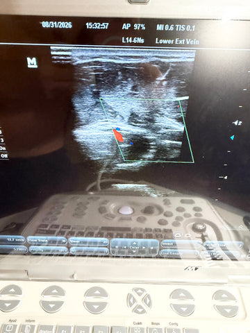 A close-up of an ultrasound machine screen showing a grayscale ultrasound scan plus a control panel below.