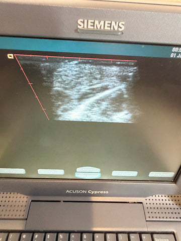 A Siemens Acuson Cypress ultrasound machine showing a grayscale ultrasound image on its screen, photographed from above.
