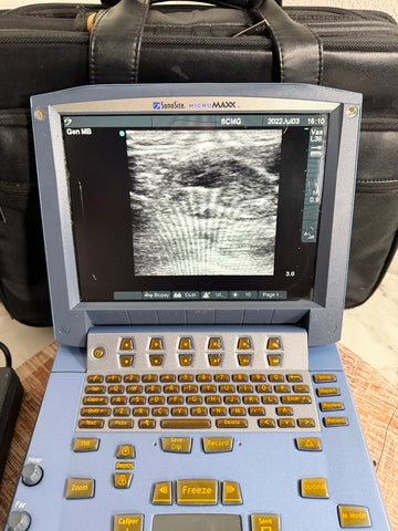 A SonoSite MicroMaxx Portable Ultrasound System with a blue-gray casing and gold buttons, displaying a grayscale ultrasound image on its screen, set against a black carrying case.