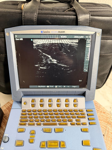 A SonoSite MicroMaxx Portable Ultrasound System with a light blue casing and gold buttons, displaying an ultrasound image on its screen, set against a black carrying case.