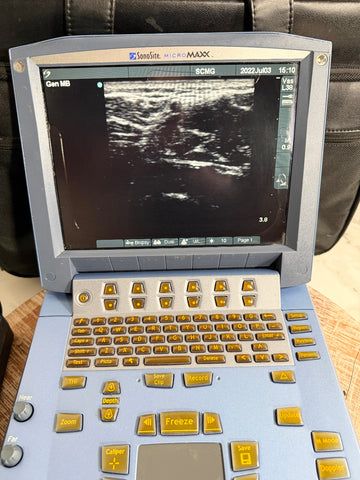 A handheld SonoSite MicroMaxx Portable Ultrasound System with a light blue-gray casing, featuring a screen displaying an ultrasound image and a keypad with yellow buttons, set against a dark leather background.