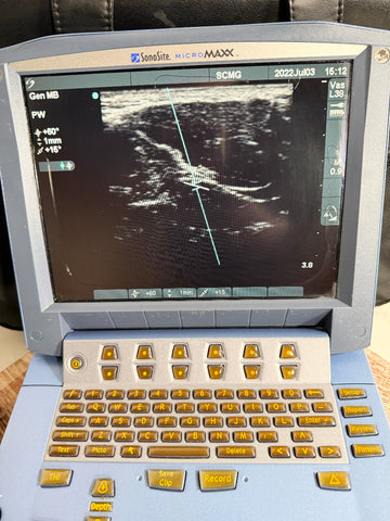 A SonoSite MicroMaxx Portable Ultrasound System with a gray and light blue casing, featuring a large screen displaying an ultrasound image and a full QWERTY keyboard below.
