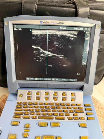A Sonosite MAXX ultrasound machine with a blue-gray casing, gold-colored buttons, and a black screen displaying an ultrasound image, set against a black carrying case background.