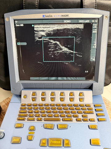 A SonoSite Micro MAXX ultrasound machine with a light blue casing, yellow buttons, and a screen displaying a grayscale ultrasound image, set against a dark leather background.