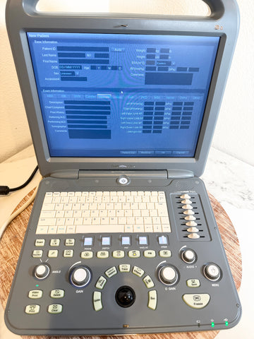 A Sonoscape ultrasound machine with a gray casing, cream-colored keyboard, and a blue display screen, shown open on a wooden surface.