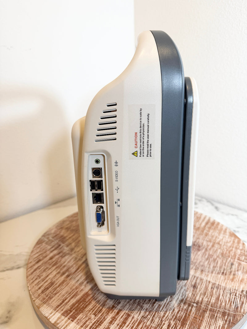 A close-up side view of the Sonoscape ultrasound machine showing its rear and side ports, set on a round wooden surface against a plain white wall.