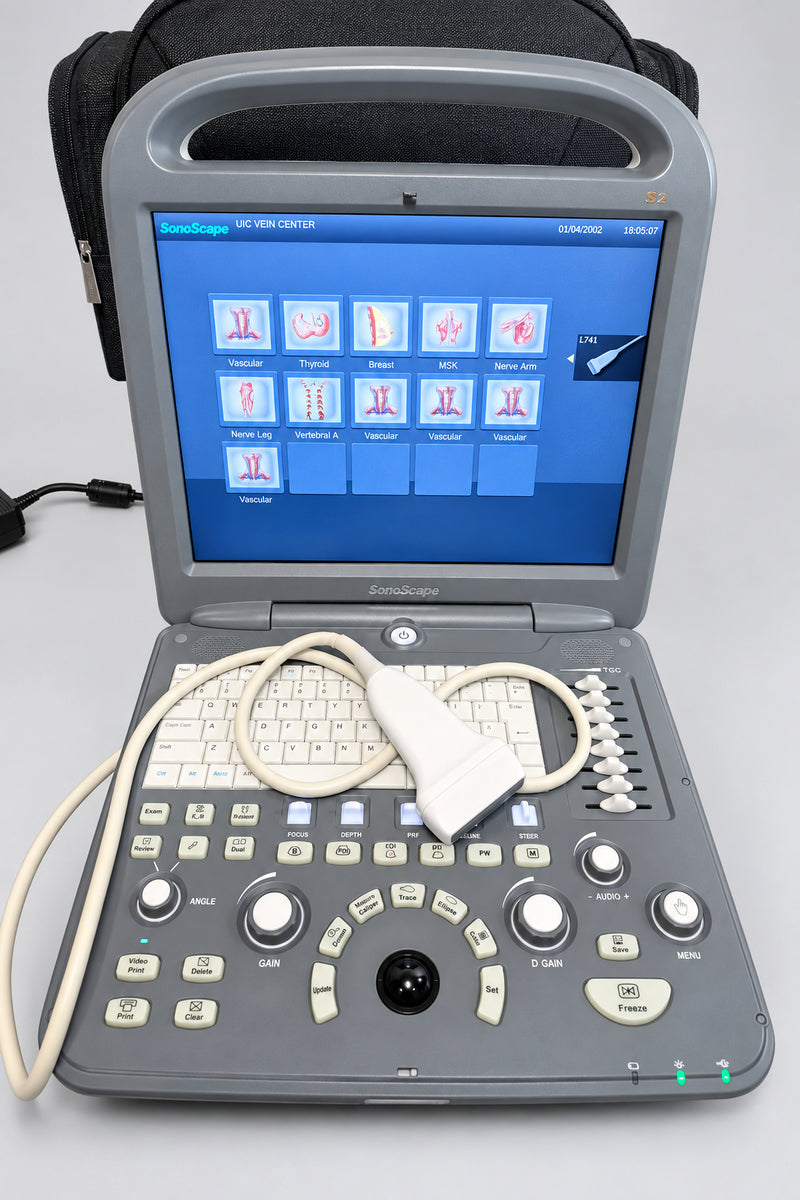 A Sonoscape ultrasound machine with a gray console, beige cables, and a touchscreen displaying medical imaging, set on a wooden surface with a black bag in the background.