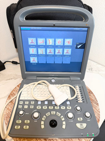 A Sonoscape ultrasound machine with a gray console, beige cables, and a touchscreen displaying medical imaging, set on a wooden surface with a black bag in the background.