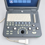 A Sonoscape ultrasound machine with a gray control console, cream-colored keyboard, and trackpad, shown sitting on a wooden surface with its monitor open.