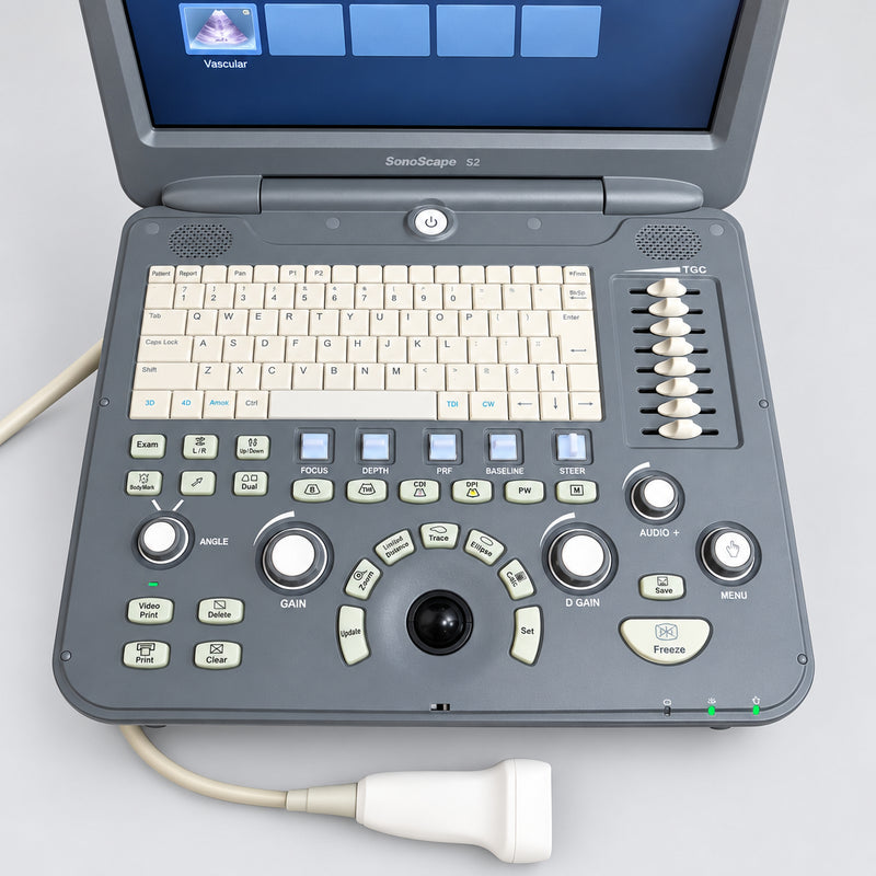 A Sonoscape ultrasound machine with a gray control console, cream-colored keyboard, and trackpad, shown sitting on a wooden surface with its monitor open.