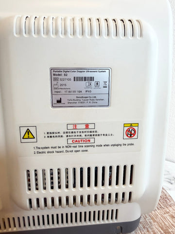 Close-up of the back of a portable Sonoscape ultrasound machine, showing vents, a product label, and warning stickers on a white plastic housing.