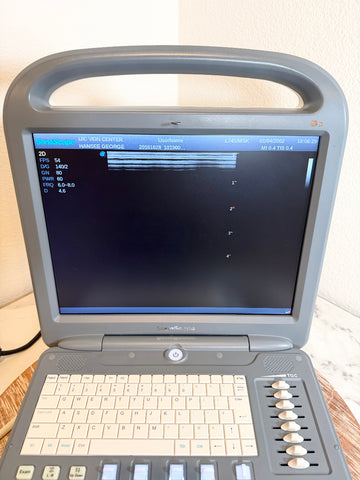 A portable Sonoscape ultrasound machine with a gray plastic housing, beige keyboard, and a black screen displaying medical imaging, set on a wooden surface against a light wall.
