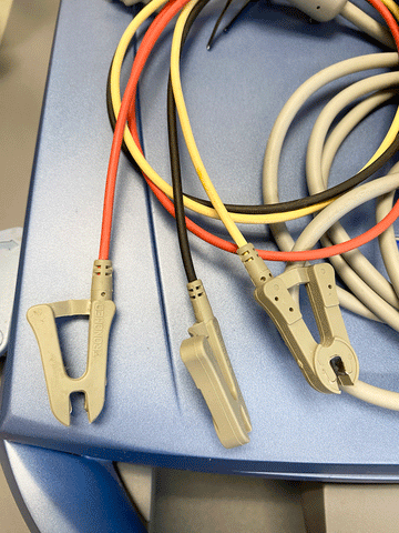 Picture of the connections for the ECG unit