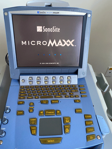 Picture of the monitor for Sonosite MicroMaxx Portable Ultrasound Machine