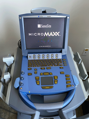 Picture of the screen for Sonosite MicroMaxx Portable Ultrasound Machine