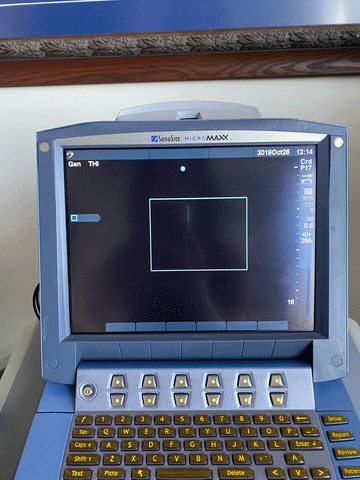 Picture of the screen for Sonosite MicroMaxx Portable Ultrasound Machine