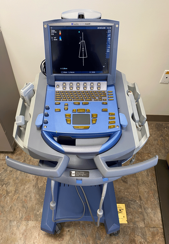Picture of the Sonosite MicroMaxx Portable Ultrasound Machine
