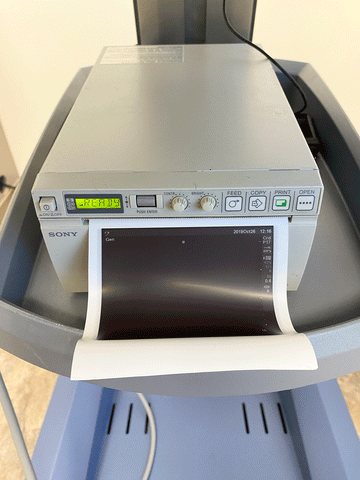 Picture of the Sony printer 