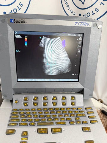 SonoSite Titan ultrasound machine with a screen displaying an ultrasound image