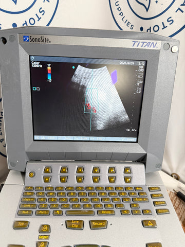 SonoSite Titan ultrasound machine with screen displaying an ultrasound image