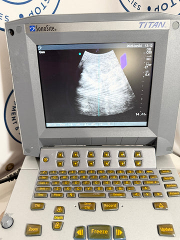SonoSite Titan ultrasound machine with screen displaying an ultrasound image
