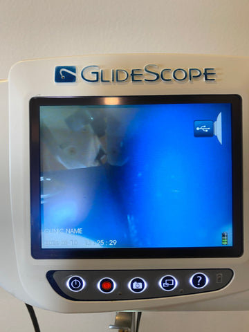 GlideScope medical device with screen displaying a video feed 