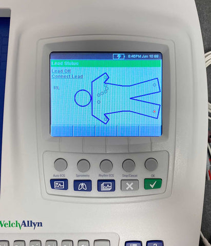 Picture of the screen for Welch Allyn CP200 Interpretive ECG with Spirometry EKG