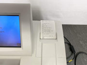 Picture of the paper that printed from Siemens Diagnostics Clinitek Advantus Urine Chemistry Analyzer